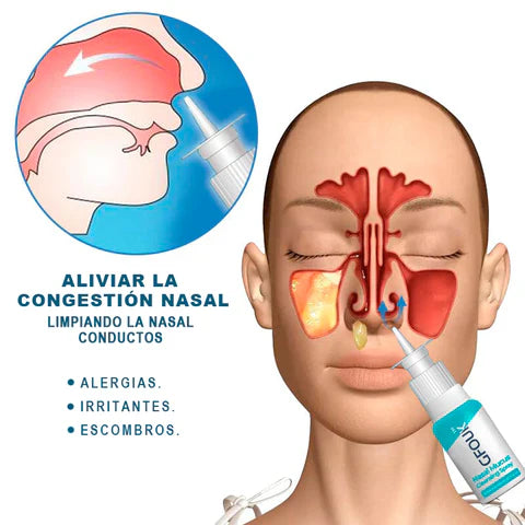 GFOUK™: "Adiós a la Congestión Nasal y  a las alergias