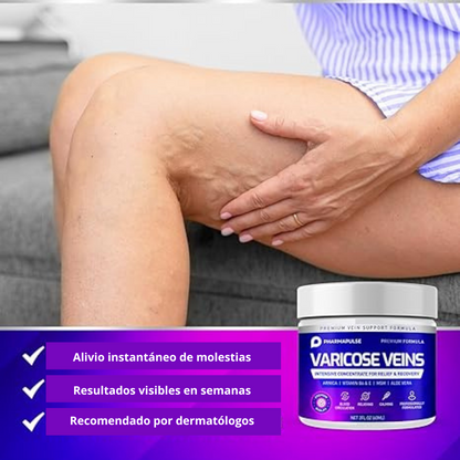 ¡Adiós a las varices y venas varicosas con VARICOSE VEINS! 🦵👋