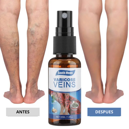 DILE ADIOS A LAS VARICES Y ARAÑITAS CON EL SPRAY VARICOSE VEINS 😲