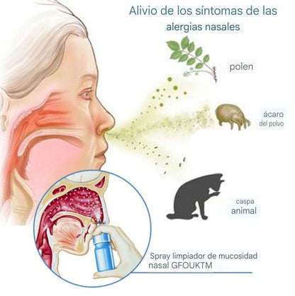 GFOUK™: "Adiós a la Congestión Nasal y  a las alergias